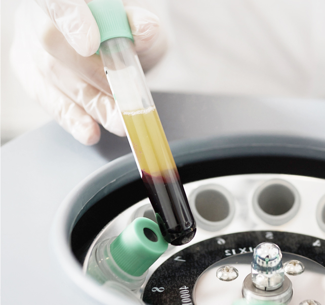 땡큐피부과 자가혈스킨부스터