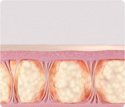 땡큐피부과 울쎄라프라임