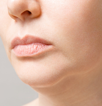 땡큐피부과 인모드