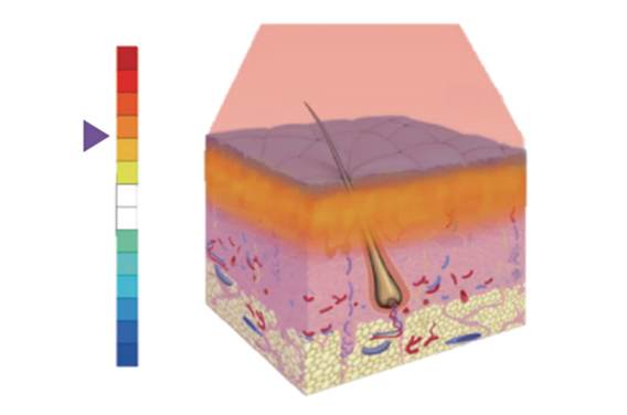 땡큐피부과 튠페이스
