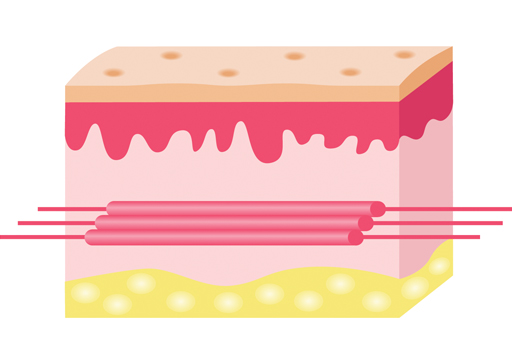 땡큐피부과 실리프팅