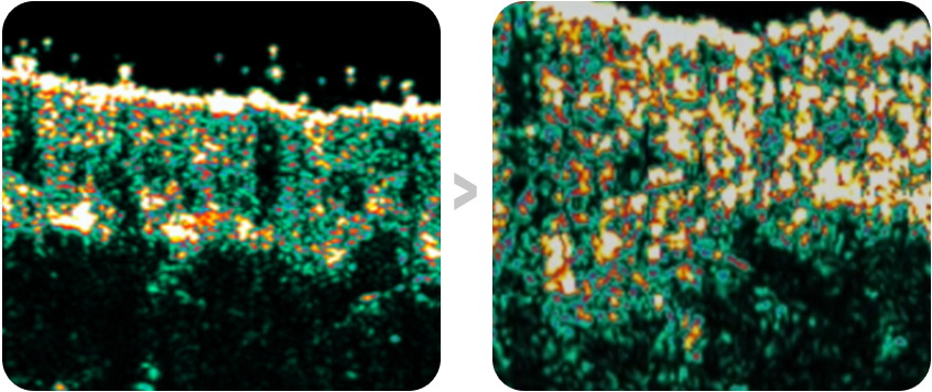 땡큐피부과 필로가135