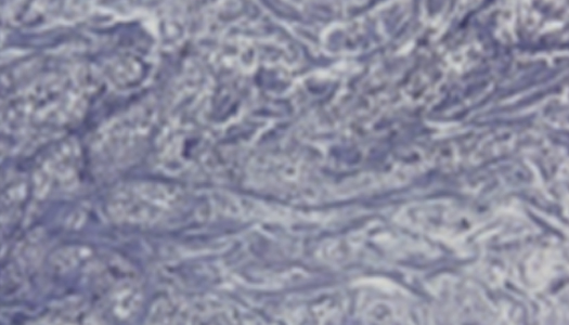 엘라비에 리투오