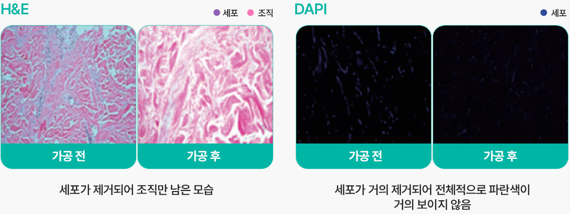 땡큐피부과 실리프팅