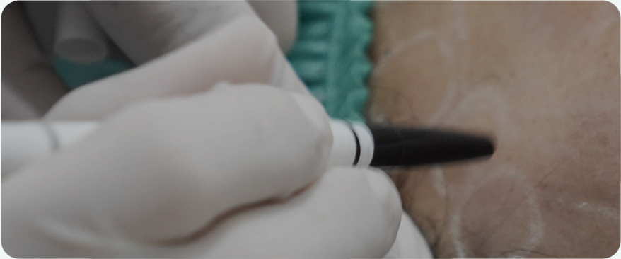 땡큐피부과 최적의 솔루션