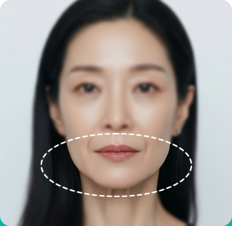 하안부 볼륨 부족형