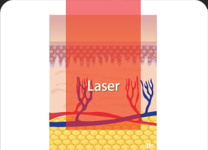 땡큐피부과 포텐자