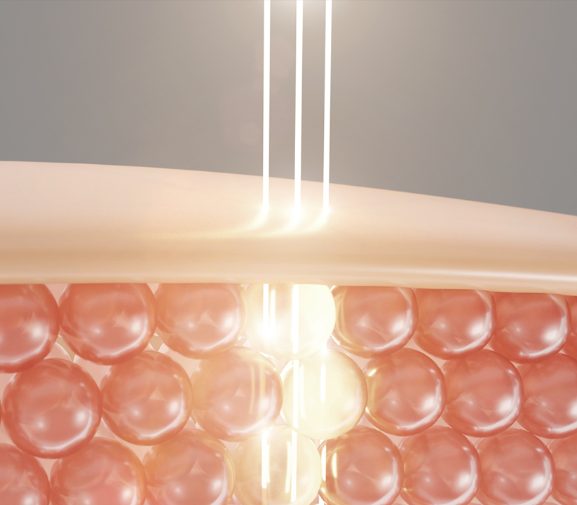 땡큐피부과 피코프락셀