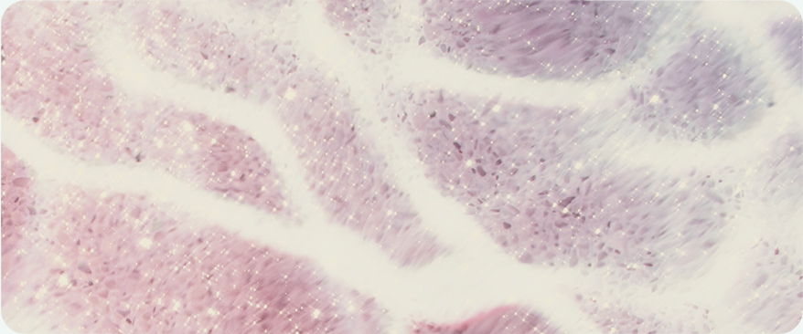 땡큐피부과 최적의 솔루션