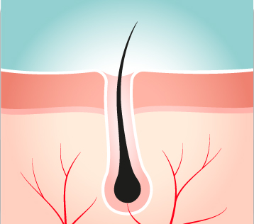 땡큐피부과 레이저 제모