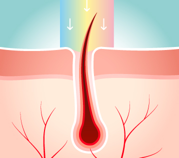 땡큐피부과 레이저 제모