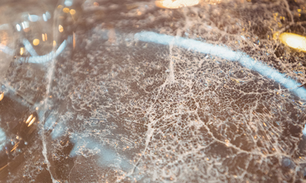 땡큐피부과 탈모 케어