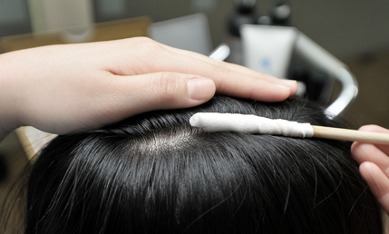 땡큐피부과 두피 케어