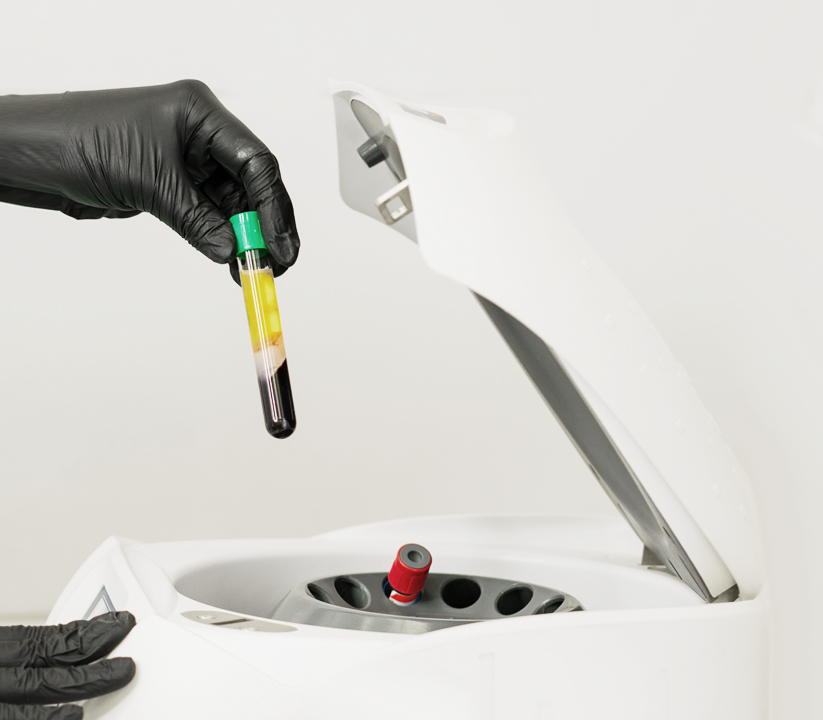 땡큐피부과 자가혈 스킨부스터