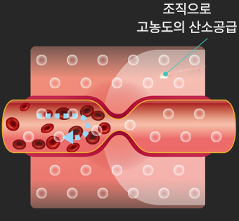아이벡스 고압산소