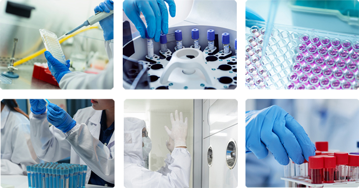 줄기세포 정밀 시스템