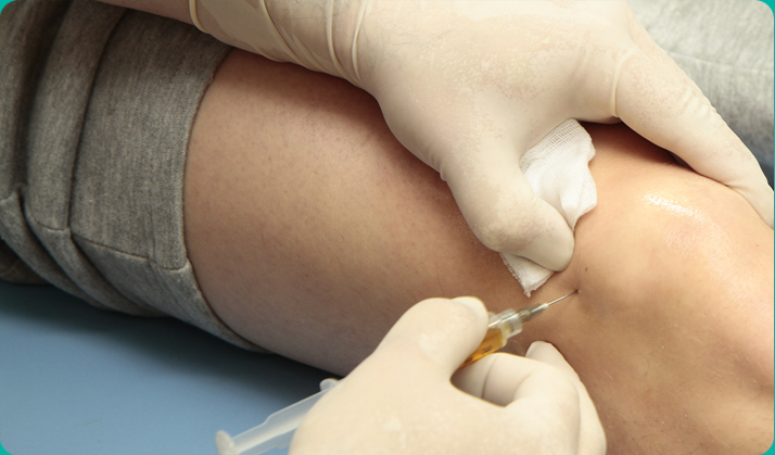 관절통증 줄기세포치료