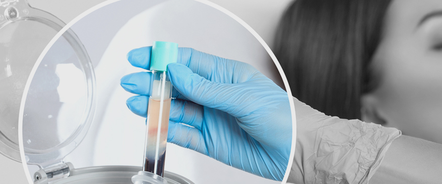 고농도 활성 줄기세포 배양 기술