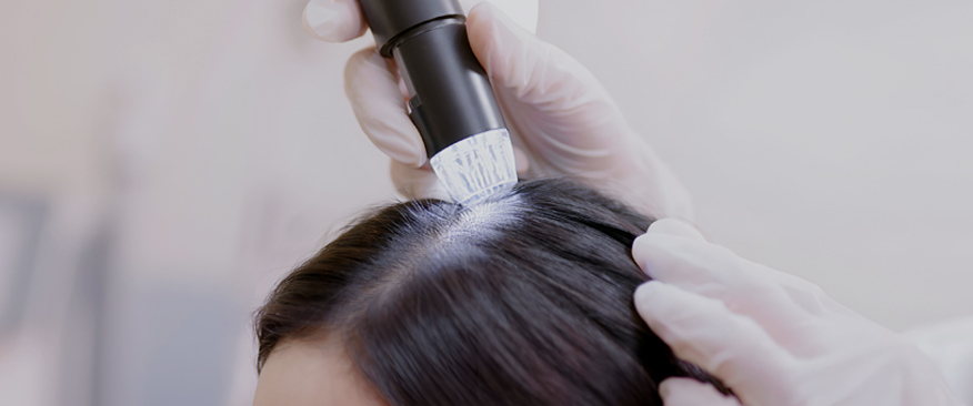 정밀 진단 시스템